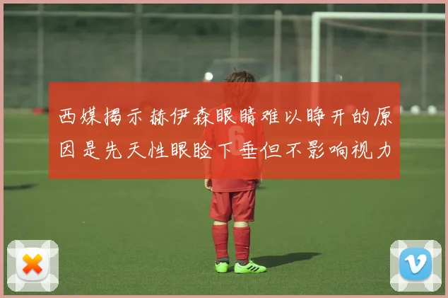西媒揭示赫伊森眼睛难以睁开的原因是先天性眼睑下垂但不影响视力